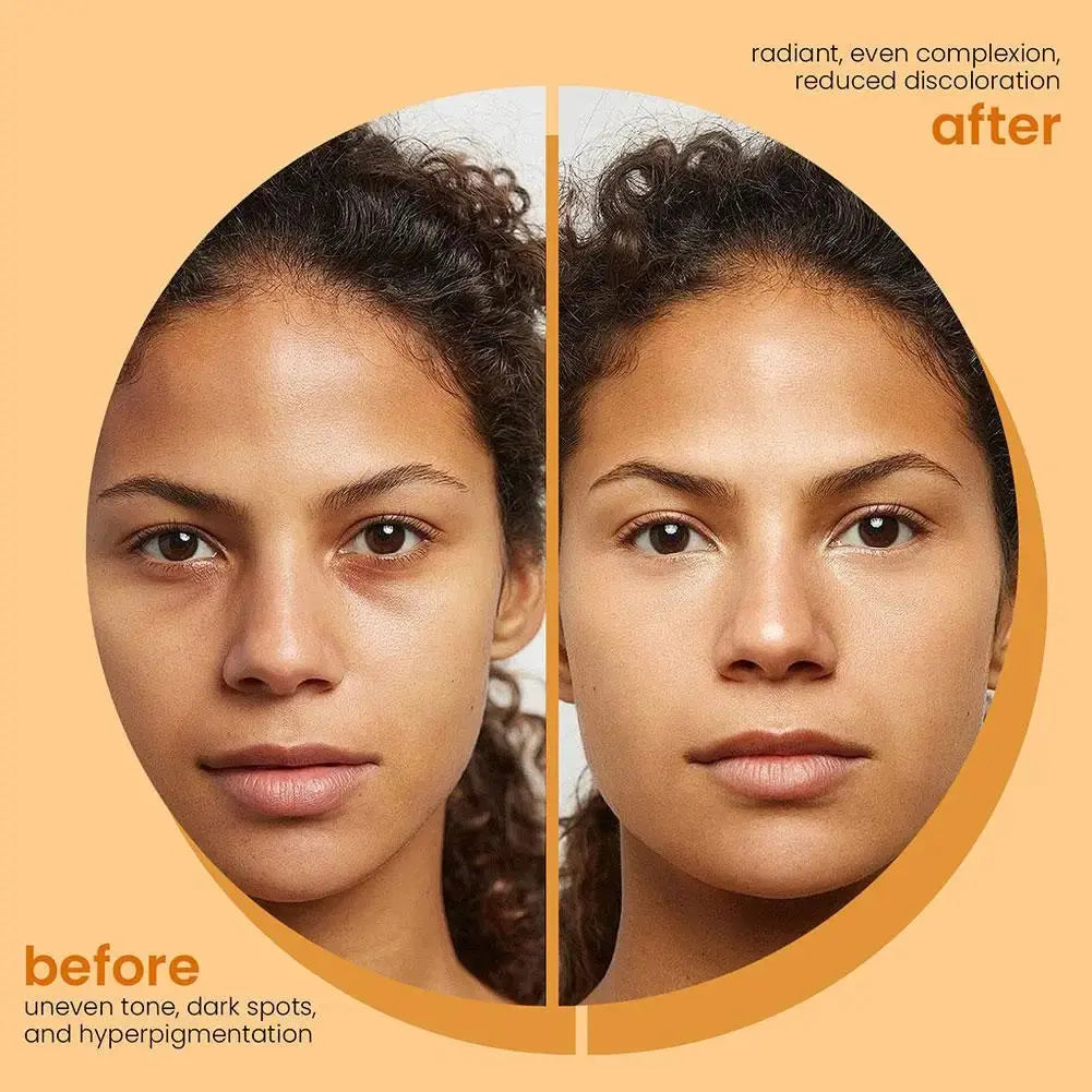 Savon fait à la main au curcuma, savon à l'acide kojique au citron, savon de douche et pour le visage, nettoyage en profondeur pour les soins de la peau du visage et du corps, 100g Marvella