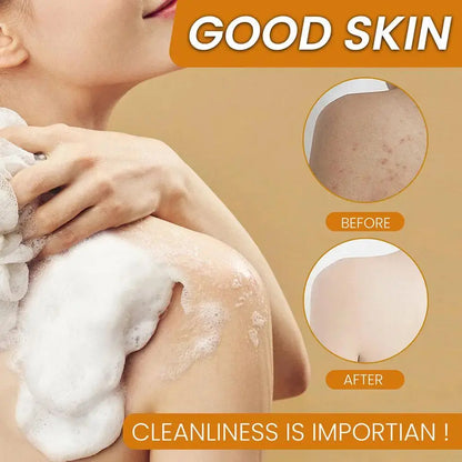 Savon fait à la main au curcuma, savon à l'acide kojique au citron, savon de douche et pour le visage, nettoyage en profondeur pour les soins de la peau du visage et du corps, 100g Marvella